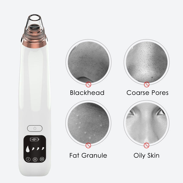 Blackhead Remover Vacuum Pore Cleaner Suction Cleaning Face Care Black Head Cleaner Acne Extractor Diamond Microdermabrasion ZopiStyle